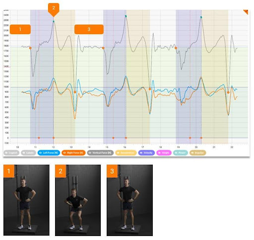 Bar chart of anterior-posterior path length across stance conditions