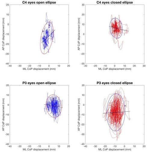 Countermovement jump phases mapped to the force-time trace